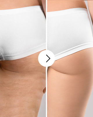 Cellinea tablets for cellulite and improving skin condition with natural extracts 60 capsules