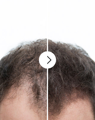 Follixin capsules for hair loss with a thickening and strengthening effect 60 capsules - 6