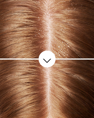 Nutridome anti-dandruff shampoo with piroctone olamine with a moisturising effect