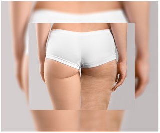 Cellinea tablets for cellulite and improving skin condition with natural extracts 60 capsules - 6