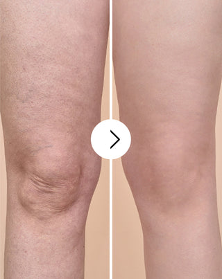 Cellinea tablets for cellulite and improving skin condition with natural extracts 60 capsules - 3