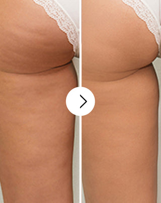 Cellinea tablets for cellulite and improving skin condition with natural extracts 60 capsules - 4