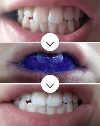 White Bite Smilebite tooth color correcting serum 30 ml - 2