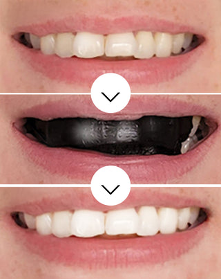 The White(ning) Stripes Smilebite teeth whitening strips set of 28 pcs. - 3