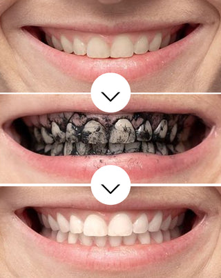 Smilebite coconut charcoal teeth whitening powder - 3